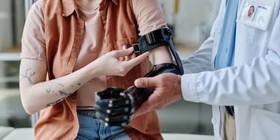 Bionics and Prosthetics - prosthetic arm